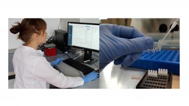 Frau Kosanke beim Vorbereiten der Realtime-PCR-Reaktion für die schnelle und genaue Diagnostik von Hautpilzerkrankungen.