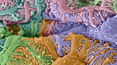 The picture shows podocytes of the mouse kidney enveloping a glomerular capillary with their foot processes. 