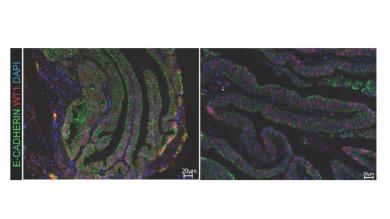 Lokalisation des Wt1 Proteins (rot) im Zellkern der Eileiter von Maus (links) und Mensch (rechts). E-Cadherin (grün) markiert Eileitergewebe; Zellkerne sind blau.   