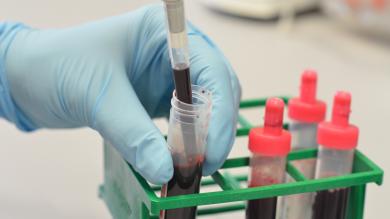 Ein Forschungsfeld, welches in den letzten Jahren durch neue technische Errungenschaften eine vielversprechende Entwicklung genommen hat, ist die sogenannte Liquid Biopsy