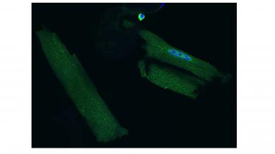 Kardiomyozyten, bei denen MIF mittels Fluoreszenzantikörper markiert wurde