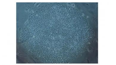 Lichtfeld-mikroskopische Aufnahmen von induzierbaren pluripotenten Stammzellen (iPSCs), generiert aus Blutzellen von CN-Patienten mit ererbter Mutation im HAX1-Gen