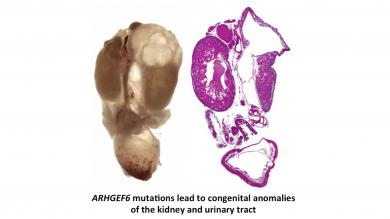Image: ARHGEF6 mutations lead to congenital anomalies of the kidney and urinary tract
