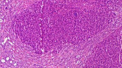 Image: S. aureus-infiziertes Gewebe