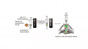 Konzept für Produktdesign und Anwendung einer CCL25-basierten Geweberegeneration bei Arthrose