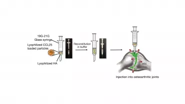 CCL25 based regeneration for treatment of osteoarthritis. Concept of product design and application.