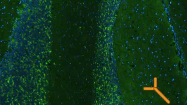 Staining of cerebellar tissue with a monoclonal  GAD-antibody