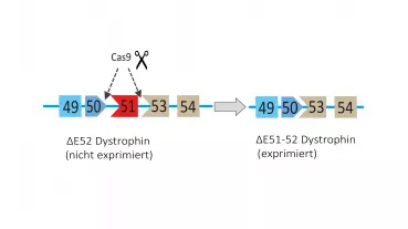 Dystrophin ∆52 lacks exon 52, which prohibits its expression as a protein. Additional excision of exon 51 restores the reading frame and expression of an internally truncated Dystrophin protein ∆51-52.