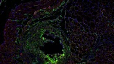 Adhesions PDPN