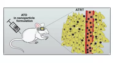 Arsenic trioxide (ATO) in nanoparticle formulation for treatment of sonic hedgehog activated atypical teratoid rhabdoid tumors (ATRT)