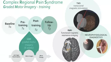 Key aspects of the CRPS-GMI study