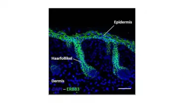 Immunofluorescence staining of murine skin. Scale bar represents 50 µm.