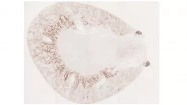 Cross section of kidney following CsA treatment. Dark areas indicate local hypoxia (Pimonidazole staining).