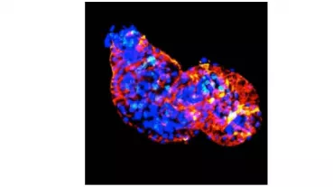 Immunofluoreszenzbild eines zwei Tage alten Zebrafischherzens