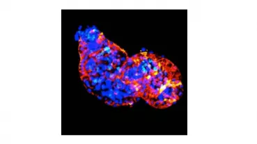 Immunofluorescent picture of a two day old zebrafish heart
