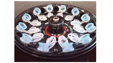 Plasmid isolation