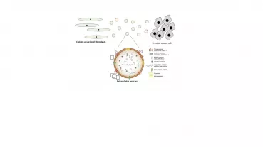 Interaction of cancer-associated fibroblasts and prostate cancer cells via extracellular vesicles (upper part). Lower part: Molecular composition of extracellular vesicles. 