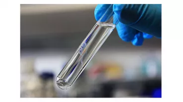 DNA Fäden im Reagenzglas. Neben der Abfolge der DNA Bausteine (Basen) spielen chemische Veränderungen der DNA Stränge eine wichtige Rolle, wie aktuell erforscht wird.