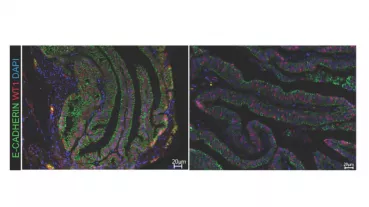 Localisation of Wt1 protein (rot) in the nuclei of oviducts of mice (left) and men (right). E-Cadherin (green) marks oviductal tissue; cell nuclei are stained in blue.
