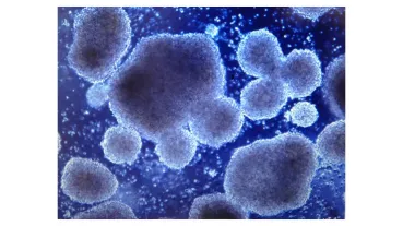 Picture of a CAR-T cell culture on day 3 of ex vivo expansion