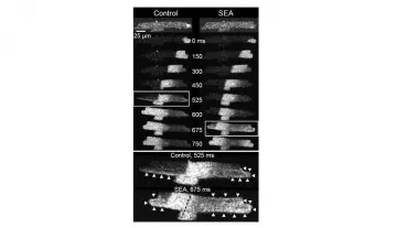 Spontane pro-arrhythmische Kalziumfreisetzung in einer atrialen Herzmuskelzelle. Die neuartige Substanz „SEA“ verzögert das Einsetzen der Zelldepolarisation und wirkt damit zellulär antiarrhythmisch.