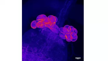 Nephrozyten der Fruchtfliege Drosophila melanogaster. Hier sieht man sogenannte Garland-Nephrozyten, die wie eine Perlenkette um die Speiseröhre der Fliege angeordnet sind