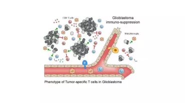 Malignant brain tumors, such as the glioblastoma, are characterized by their therapeutic resistance and invasive growth. 