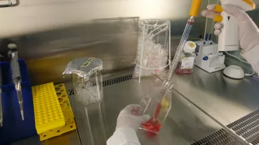 This research project investigates the function of a protein naturally produced in the body. This protein may be able to protect the arteries from calcification. 