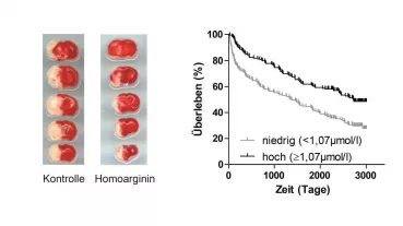 Homoarginine supplementation reduces infact size (white) in experimental stroke models (left) and higher homoarginine levels in patients are associated with increased survival rates after stroke (right)