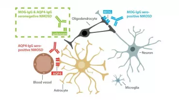 Autoantibodies in Neuromyelitis optica spectrum disorders.  