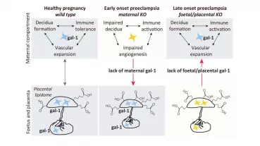 Investigation of galectin-1-sugar-metabolome axis during healthy and preeclamptic pregnancies