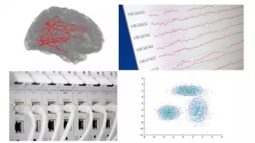 The corticobasal syndrome (CBS) is a rare brain disorder similar to Parkinson’s disease. In addition to causing motor symptoms, CBS affects cognitive aspects of motor control. 