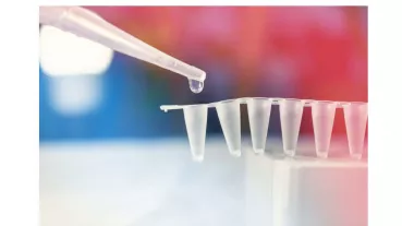 Tissue replacement of damaged joints with human bone marrow-derived stem cells is a promising therapeutic option in regenerative medicine. 