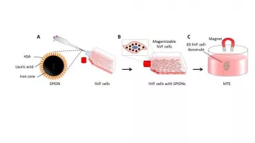Caption: Schematic representation of Magnetic Tissue Engineering (MTE): A) Superparamagnetic iron oxide nanoparticles (SPION) uptake; (b) magnetic cell hybrids; C) 3D vocal fold cell-construct