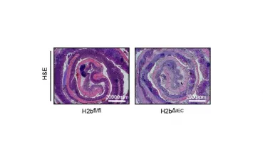 Colitis in mice carrying epithelial specific deletion of RNaseH2b in the intestinal epithelium