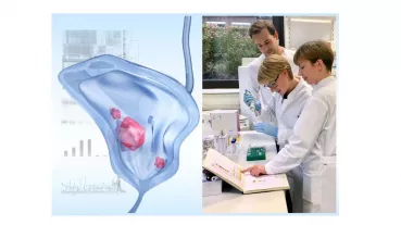 Left: Bladder cancer is molecularly diverse. By combination of different methods including high-througput analyses we investigate proteins involved. Right: Dr. F. Dressler, J. Schoenfeld and Biologist O. Revyakina (from left to right) 