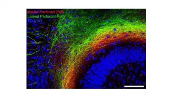 Visualisation of the entorhino-hippocampal projection in vitro using viral tracing. Scale bar = 150 µm.