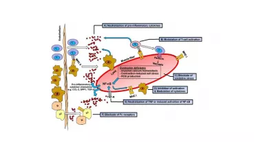 Overview of inflammatory mechanisms in Duchenne muscular dystrophy and beneficial effects of immunoglobulin G.