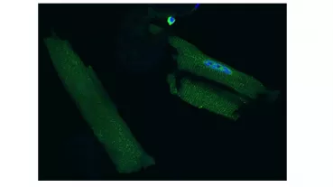 Fluorescence labeled MIF in cardiomyocites