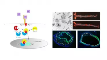 BMP in cardiovascular diseases