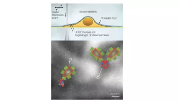 Approved drugs for HER2 positive breast cancer lose their efficacy in many patients eventually as drug resistance develops; the causes are not sufficiently known to develop more effective new medicines. 