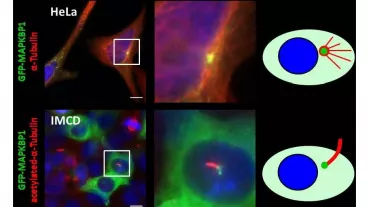 Centrosomal and ciliary localization of GFP-MAPKBP1