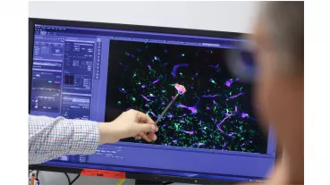 Caption: The subject of the Heidelberg Research College for Neurooncology is „Resistance in primary brain tumours“. 