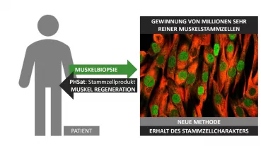 Projektskizze für die Generierung, Vermehrung und autologen Transplantation von primären humanen Muskelstammzellen.