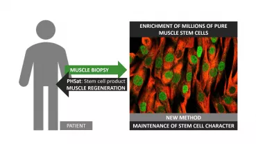 Project plan to obtain, propagate, and transplant  primary human muscle stem in an autologous setting.
