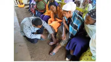 Nurse examining people with podoconiosis