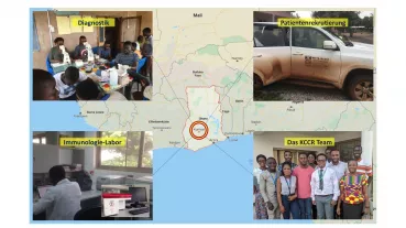 Collaboration with African partners to investigate reasons for different onset age of Type 1 Diabetes in Germany and Ghana