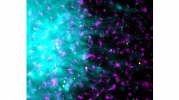 Image: Caption: T cells (yellow)-Microglia (magenta)-Tumor (cyan) crosstalk in a human neocortical slice model