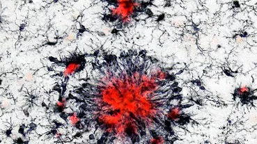 Image: Immune cells