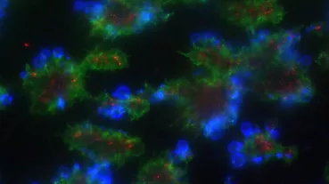 Image: Platelets & thrombus formation